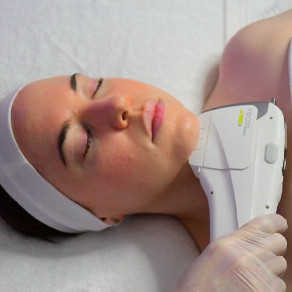 hifu neck treatment HIFU,Treatment,Skin Treatment,Wrinkle Reduction,Beauty Salon,Beaubelle,Collagen